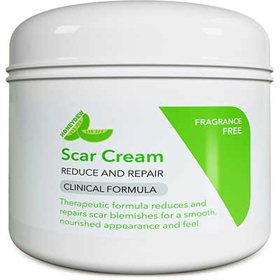 Best Scar Removal Cream for Old Scars