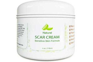 best scar removal creams reviews